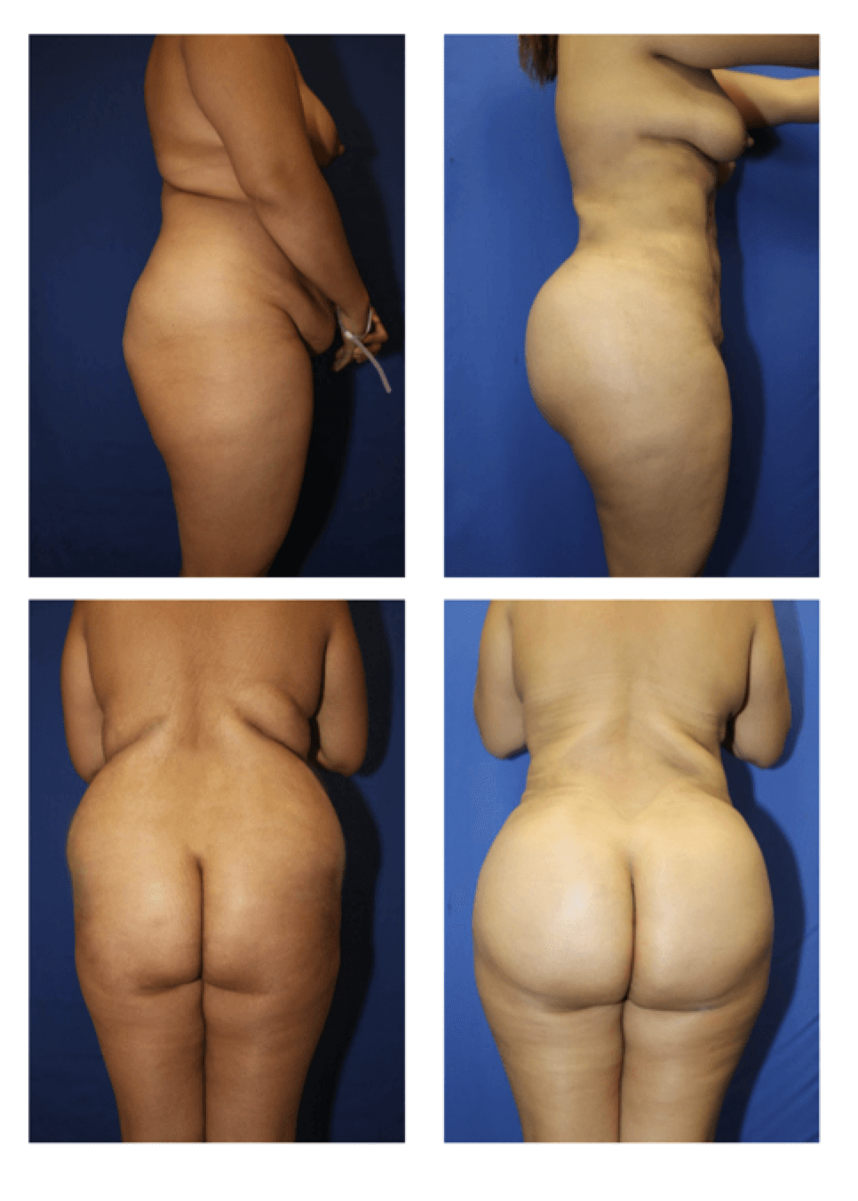 before and after